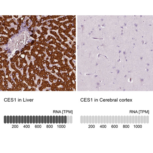 Immunohistochemistry analysis in human liver and cerebral cortex tissues using HPA046717 antibody. Corresponding CES1 RNA-seq data are presented for the same tissues.