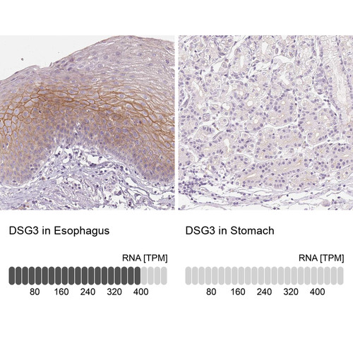 Immunohistochemistry analysis in human esophagus and stomach tissues using Anti-DSG3 antibody. Corresponding DSG3 RNA-seq data are presented for the same tissues.