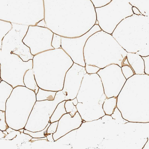Immunohistochemical staining of human adipose tissue shows strong granular cytoplasmic positivity in adipocytes.