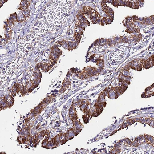 Immunohistochemical staining of human fallopian tube shows strong cytoplasmic and membranous positivity in glandular cells.