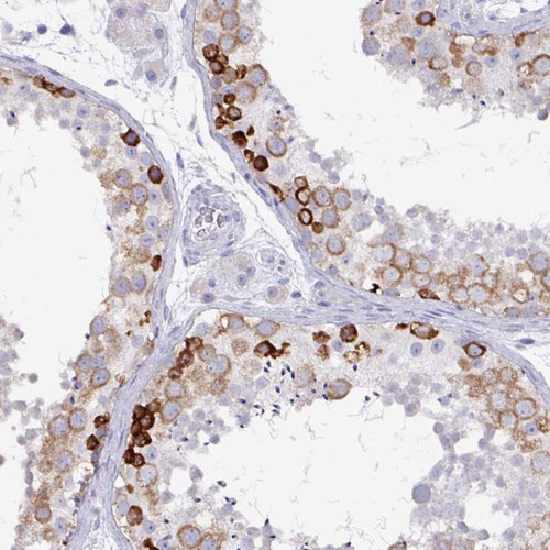 Immunohistochemical staining of human testis shows strong cytoplasmic positivity in cells in seminiferous ducts.