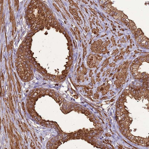 Immunohistochemical staining of human prostate shows strong cytoplasmic and membranous positivity in glandular cells.