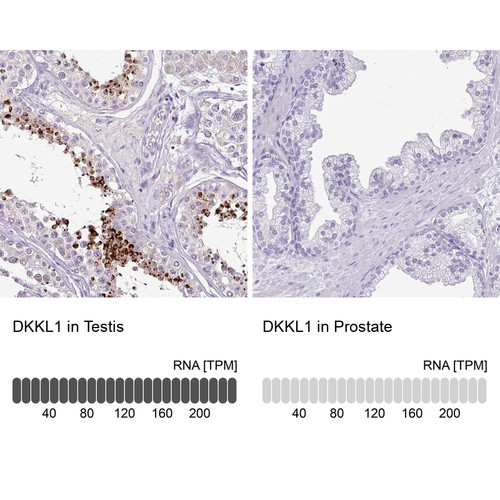 Immunohistochemistry analysis in human testis and prostate tissues using Anti-DKKL1 antibody. Corresponding DKKL1 RNA-seq data are presented for the same tissues.