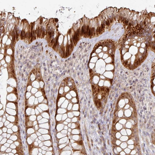 Immunohistochemical staining of human colon shows strong cytoplasmic positivity in glandular cells.
