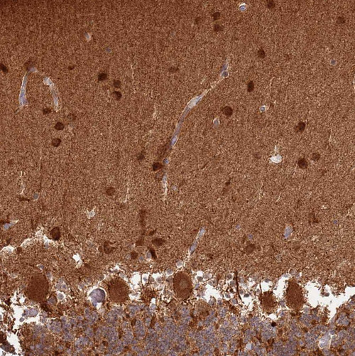 Immunohistochemical staining of human cerebellum shows strong cytoplasmic positivity in all layers.