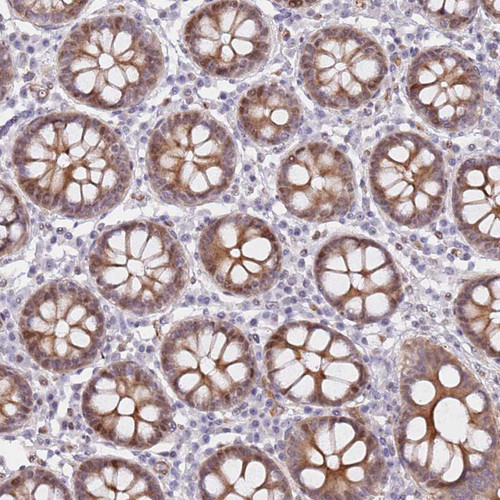 Immunohistochemical staining of human colon shows moderate cytoplasmic and nuclear positivity in glandular cells.