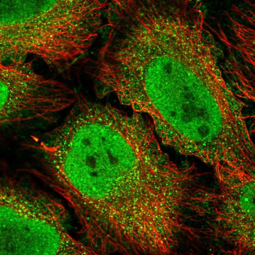 Immunofluorescent staining of human cell line HeLa shows localization to nucleoplasm, cytosol, midbody & vesicles.