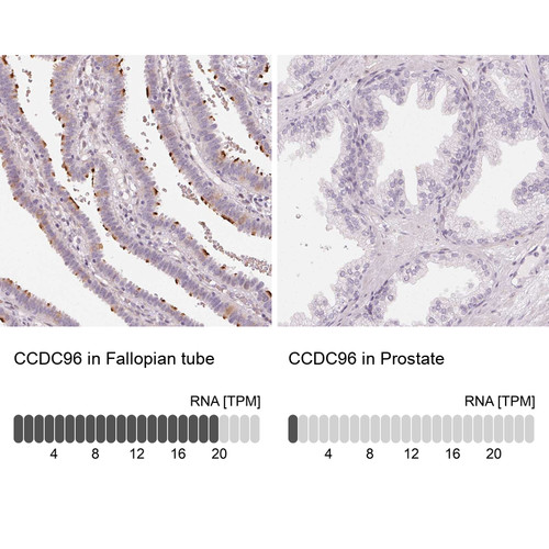 Immunohistochemistry analysis in human fallopian tube and prostate tissues using Anti-CCDC96 antibody. Corresponding CCDC96 RNA-seq data are presented for the same tissues.