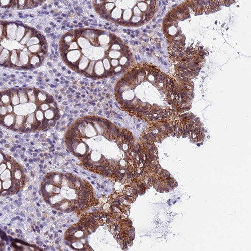 Immunohistochemical staining of human colon shows moderate cytoplasmic and membranous positivity in glandular cells.