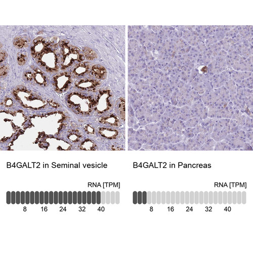 Immunohistochemistry analysis in human seminal vesicle and pancreas tissues using Anti-B4GALT2 antibody. Corresponding B4GALT2 RNA-seq data are presented for the same tissues.