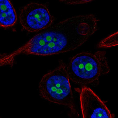 Immunofluorescent staining of human cell line PC-3 shows localization to nucleoli.