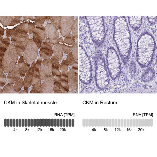 Immunohistochemistry analysis in human skeletal muscle and rectum tissues using HPA047859 antibody. Corresponding CKM RNA-seq data are presented for the same tissues.