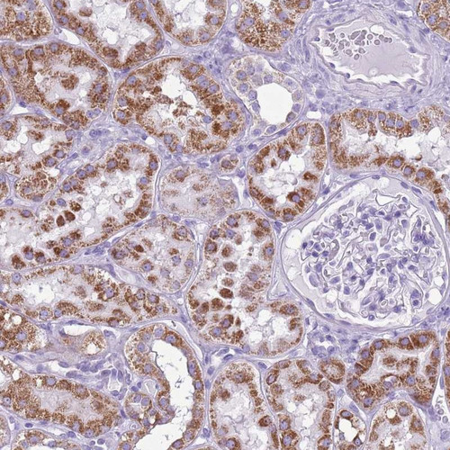 Immunohistochemical staining of human kidney shows strong cytoplasmic positivity in cells in tubules.