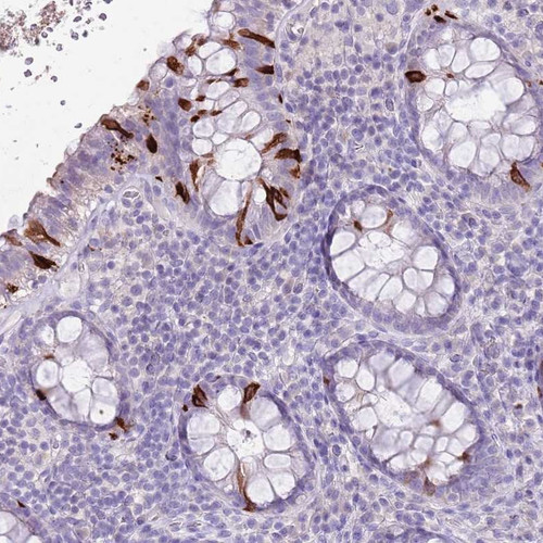 Immunohistochemical staining of human rectum shows strong cytoplasmic positivity in glandular cells.