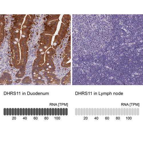 Immunohistochemistry analysis in human duodenum and lymph node tissues using Anti-DHRS11 antibody. Corresponding DHRS11 RNA-seq data are presented for the same tissues.