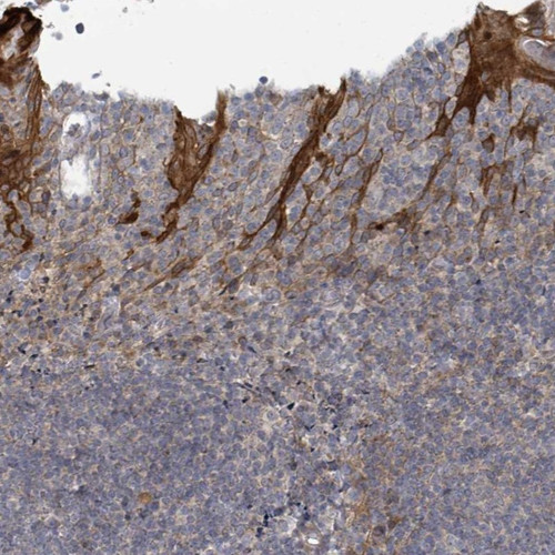 Immunohistochemical staining of human tonsil shows cytoplasmic and extracellular positivity in squamous epithelium.