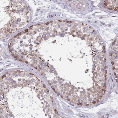 Immunohistochemical staining of human testis shows moderate cytoplasmic positivity in subset of cells in seminiferous ducts.