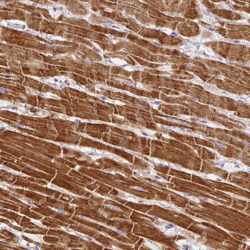 Immunohistochemical staining of human heart muscle shows strong cytoplasmic positivity in myocytes.