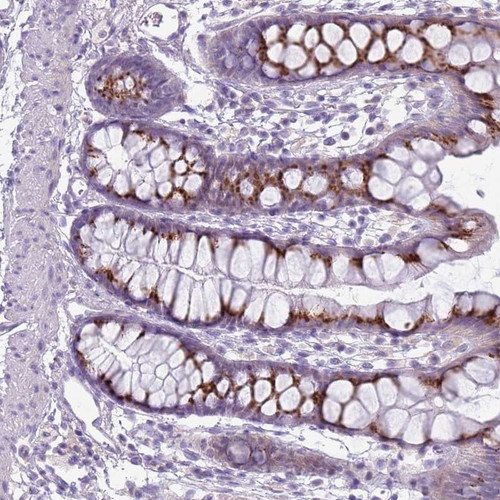 Immunohistochemical staining of human rectum shows strong cytoplasmic positivity with a granular pattern in glandular cells.