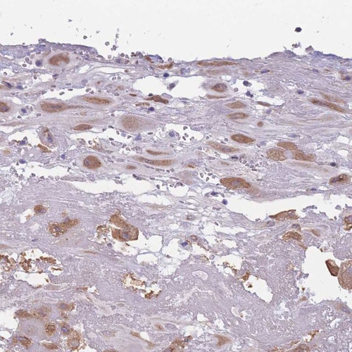 Immunohistochemical staining of human placenta shows cytoplasmic positivity in decidual cells.