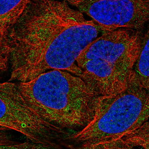 Immunofluorescent staining of human cell line U-2 OS shows localization to endoplasmic reticulum & rods & rings.