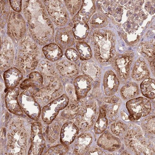 Immunohistochemical staining of human kidney shows strong cytoplasmic positivity in cells in tubules.