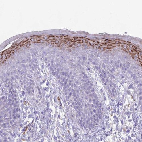 Immunohistochemical staining of human skin shows moderate cytoplasmic positivity in epidermal cells.