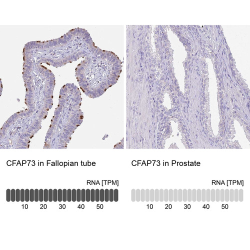 Immunohistochemistry analysis in human fallopian tube and prostate tissues using Anti-CFAP73 antibody. Corresponding CFAP73 RNA-seq data are presented for the same tissues.
