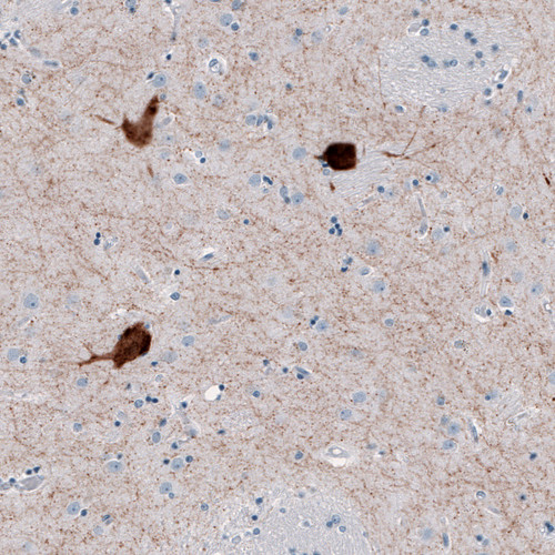 Immunohistochemical staining of human caudate nucleus shows strong cytoplasmic positivity in a large neurons.