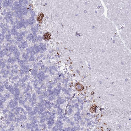Immunohistochemical staining of human cerebellum shows strong cytoplasmic positivity in granular pattern in Purkinje cells.
