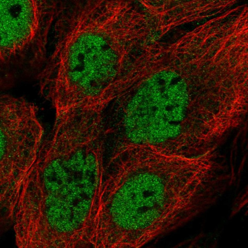 Immunofluorescent staining of human cell line A-431 shows localization to nucleoplasm.