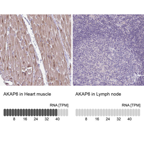 Immunohistochemistry analysis in human heart muscle and lymph node tissues using HPA048741 antibody. Corresponding AKAP6 RNA-seq data are presented for the same tissues.