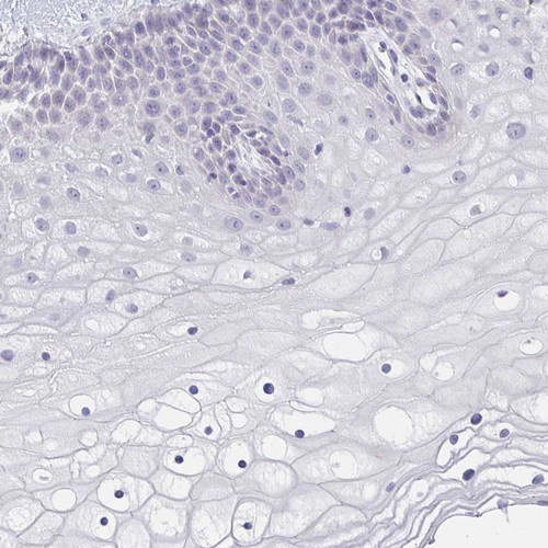 Immunohistochemical staining of human cervix, uterine shows no positivity in squamous epithelial cells as expected.