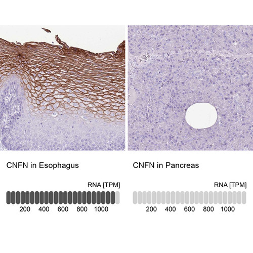Immunohistochemistry analysis in human esophagus and pancreas tissues using Anti-CNFN antibody. Corresponding CNFN RNA-seq data are presented for the same tissues.