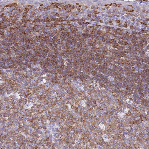 Immunohistochemical staining of human tonsil shows strong cytoplasmic positivity in non-germinal center cells.