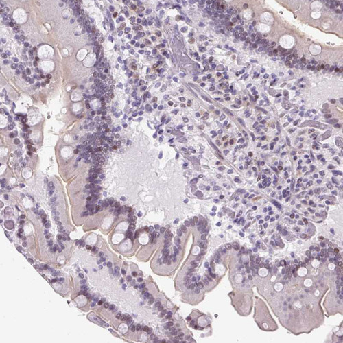 Immunohistochemical staining of human duodenum shows weak membranous positivity in glandular cells.