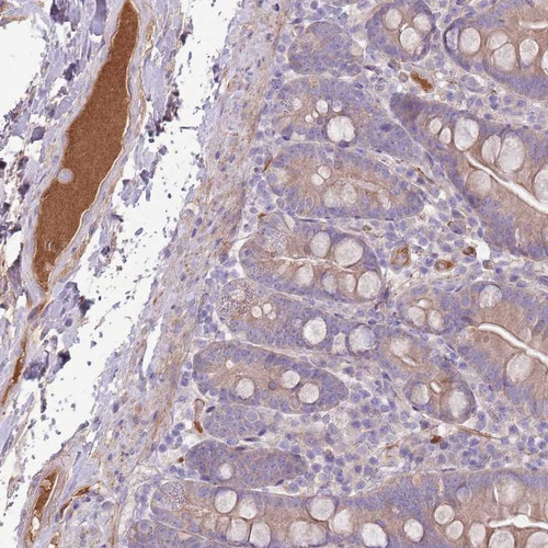 Immunohistochemical staining of human small intestine shows strong plasma positivity.