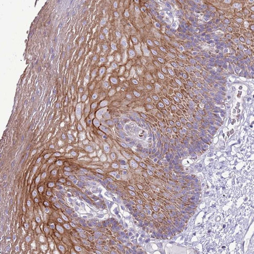 Immunohistochemical staining of human esophagus shows distinct cytoplasmic and membranous positivity in superficial squamous epithelial cells.