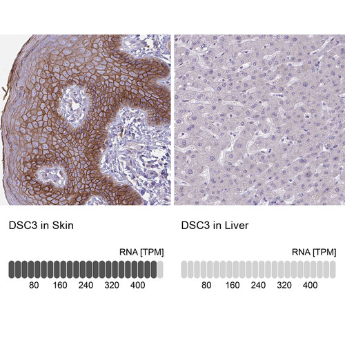 Immunohistochemistry analysis in human skin and liver tissues using HPA049265 antibody. Corresponding DSC3 RNA-seq data are presented for the same tissues.
