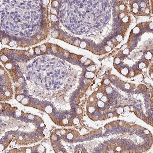 Immunohistochemical staining of human small intestine shows strong membranous and cytoplasmic positivity.