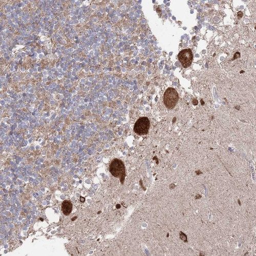 Immunohistochemical staining of human cerebellum shows strong cytoplasmic positivity in Purkinje cells.
