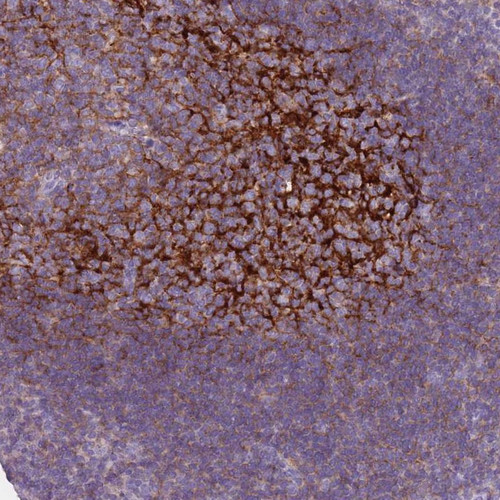 Immunohistochemical staining of human tonsil shows distinct reticular positivity in germinal center.
