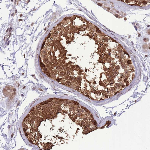 Immunohistochemical staining of human testis shows strong cytoplasmic and nuclear positivity in cells of seminiferus ducts.