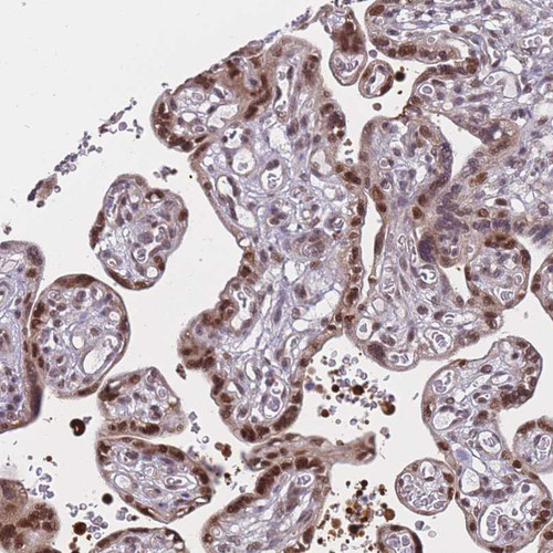 Immunohistochemical staining of human placenta shows moderate to strong nuclear positivity in trophoblastic cells.