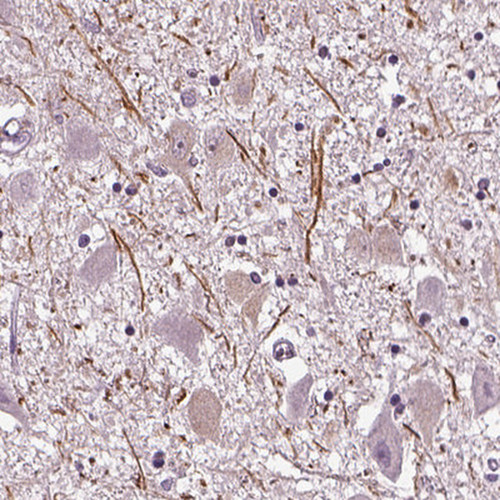 Immunohistochemical staining of human hypothalamus shows strong positivity in neuronal projections.