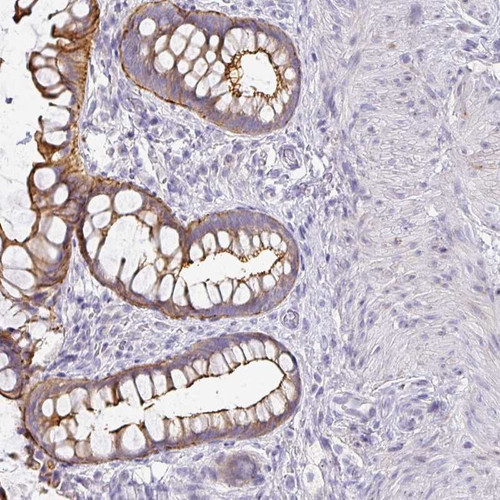 Immunohistochemical staining of human rectum shows strong membranous and cytoplasmic positivity in glandular cells.
