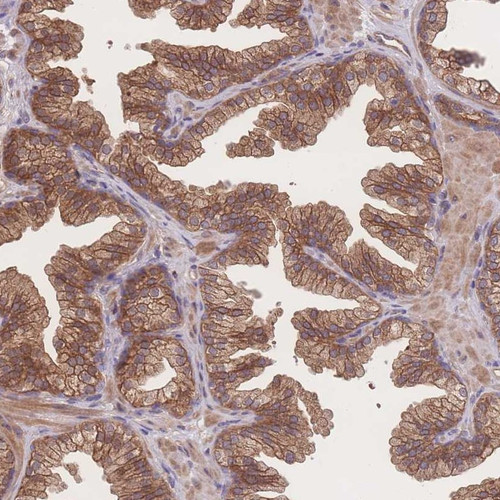 Immunohistochemical staining of human prostate shows moderate cytoplasmic and membranous positivity in glandular cells.