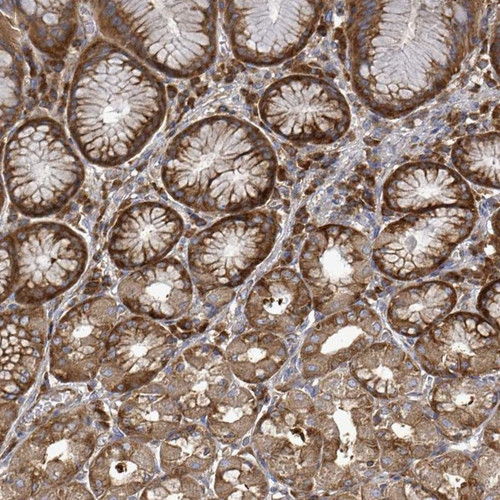 Immunohistochemical staining of human stomach, lower shows strong cytoplasmic positivity in glandular cells.