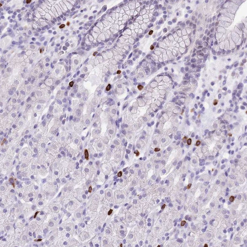 Immunohistochemical staining of human stomach (upper) shows distinct cytoplasmic positivity in a subset of peripheral leukocytes.