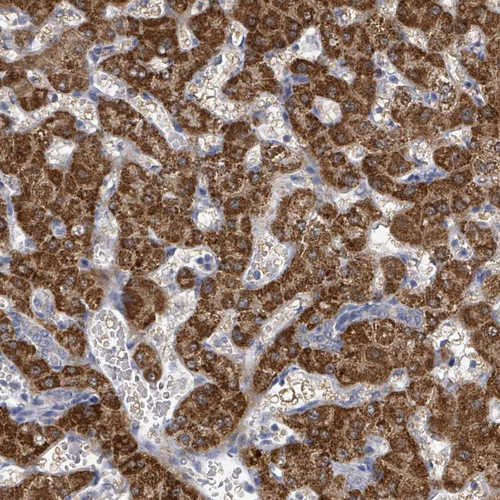 Immunohistochemical staining of human liver shows strong cytoplasmic positivity in hepatocytes.